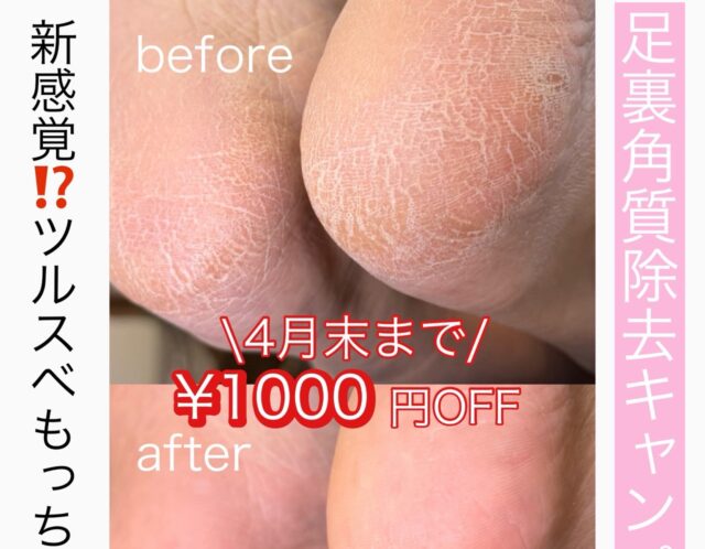 【足裏角質除去キャンペーン🦶✨】